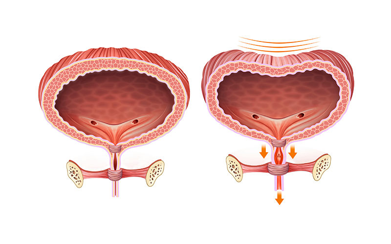 Pelvic Girdle Pain in Pregnancy : Milltown Physiotherapy