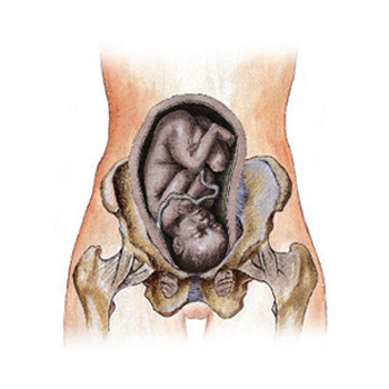 Pelvic Girdle Pain in Pregnancy : Milltown Physiotherapy